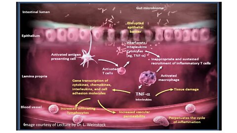 Low Dose Naltrexone & IBD/IBS 4thAnnFxMedSymposium