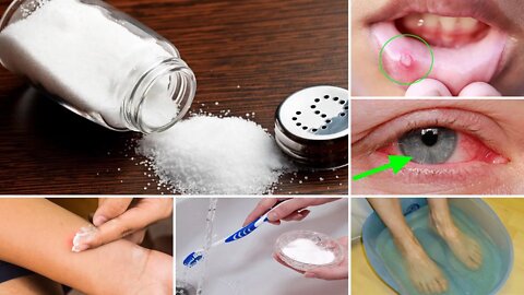 10 Unusual and Healthy Uses of Common Salt