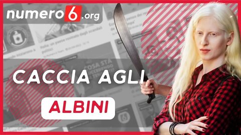 Caccia agli albino in Africa: la maledizione del continente