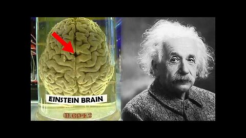 How Einstein's Brain was Different?