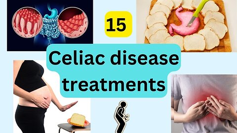 15 Celiac disease treatments