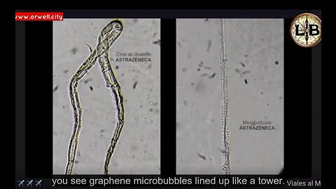 Graphene oxide and microtechnology found in vaccination vials analyzed in Argentina - 1-27-22