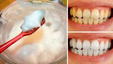 How to Naturally Whiten Your Teeth at Home In 3 Minutes