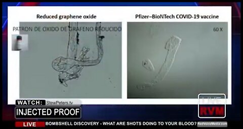 ¡IMPACTANTE! mira la diferencia de la sangre con y sin vacuna covid 19 bajo el microscopio