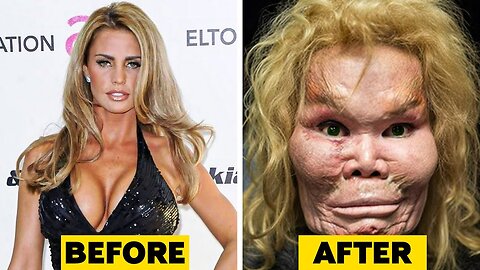 20 Celebrity Plastic Surgery Disasters