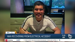 San Ysidro man staying positive after surviving electricity accident and amputation