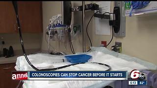 Colonoscopies can stop cancer before it starts