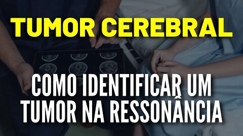 Tumor Cerebral - Como Identificar um Tumor na Ressonância