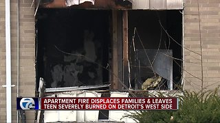 Teen burned in suspicious Detroit fire