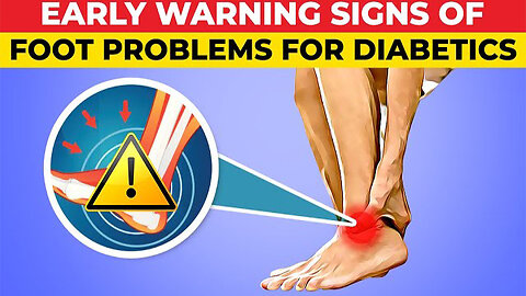 Early Warning Signs of Foot Problems For Diabetics