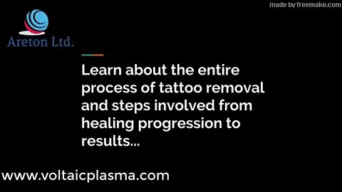 Plasma Tattoo Removal Case Study Trailer