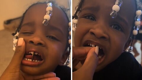 Toddler gets penny stuck in between her teeth
