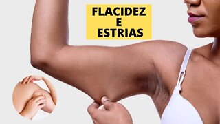 FLACIDEZ E ESTRIAS COMO PREVINIR, TRATAR E ALIMENTOS BONS