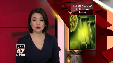 1st MI confirmed case of Acute Flaccid Myelitis