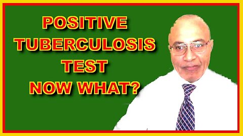 Tuberculosis (What The Positive Test Means)