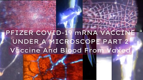 PFIZER COVID-19 mRNA VACCINE UNDER A MICROSCOPE - PART 2 - Blood From Vaxed