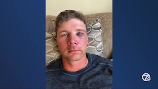 Tigers catcher Grayson Greiner breaks nose after hit by pitch