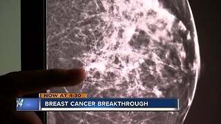 New technology benefits breast cancer patients