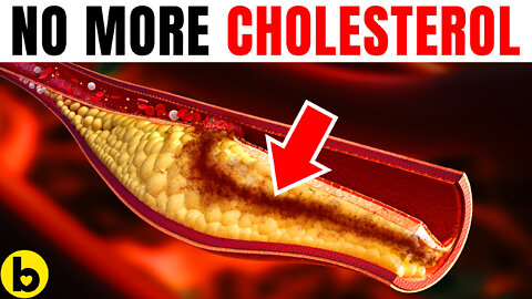 9 Simple Hacks To Lower Cholesterol Without Medication