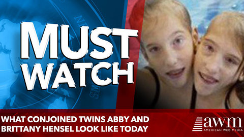 What Conjoined Twins Abby And Brittany Hensel Look Like Today