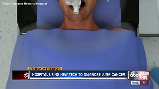 Sarasota doctors use robotic cameras to screen for lung cancer