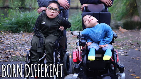 Cousins' Ultra-Rare Condition Makes Them 'Twins' | BORN DIFFERENT