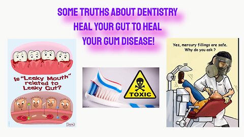 Heal Your Gut to Heal Your Gum Disease - Mercury fillings, Root Canals and Leaky Gut - Marina Carew
