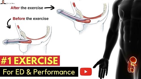 Exercise For Preventing Erectile Dysfunction & Improving Your Performance In The Bedroom