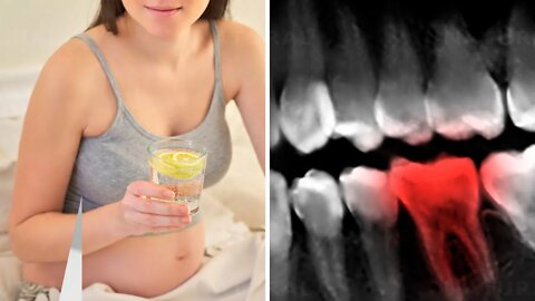 Lemon Water Is Destroying Your Teeth, Here Is How To Fix It!