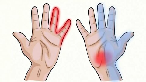 7 Things Your Hands Can Tell You About Your Health