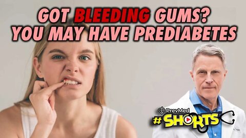 #SHORTS - Got Bleeding Gums?