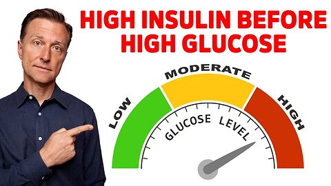 High Insulin Before High Blood Sugar Levels – Dr. Berg