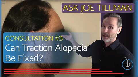 Can Traction Alopecia Be Fixed? Joe Tillman Talks About It.
