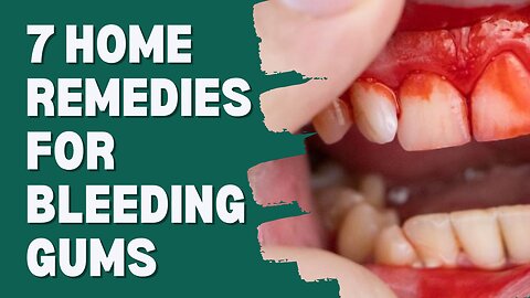 7 Home Remedies For Bleeding Gums