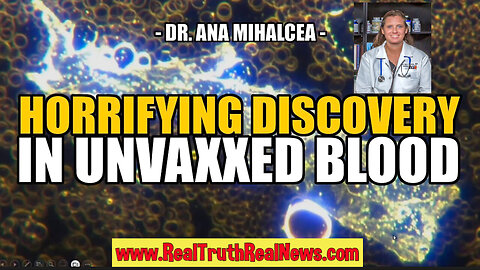 💥💉 SHOCKING! Dr. Ana Mihalcea Discovers Horrifying Nano-Tech and Rubbery Clots in UNVACCINATED Blood - EVERYBODY is Infected! * Detox Links Below 👇