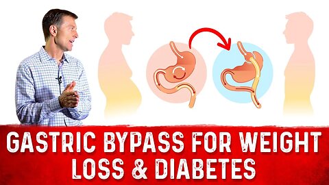 The Reason Why Gastric Bypass Works for Weight Loss & Diabetes – Dr. Berg