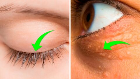 9 Things Your Eyes Can Tell About Your Health