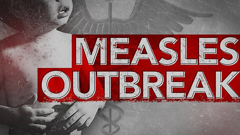 Chicago Measles Outbreak