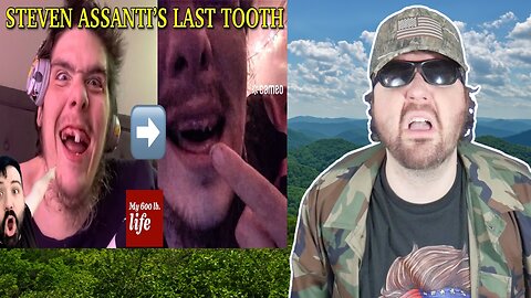 Steven Assanti's One Last Tooth Finally Came Out (FatBoyGetDown) (WiLLo Davis) - Reaction! (BBT)
