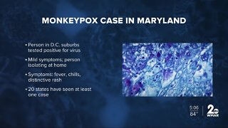 MDH reports first Monkeypox case found in Maryland resident