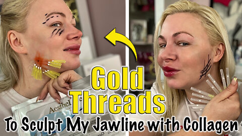 Gold Threads to Sculpt my Jawline with Collagen from AceCosm.com | Code Jessica10 Saves you Money!