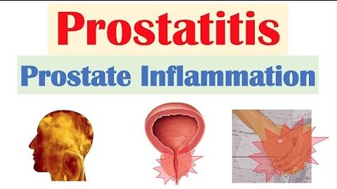 Prostatitis (Prostate Inflammation): Different Types, Causes, Signs & Symptoms, Diagnosis, Treatment