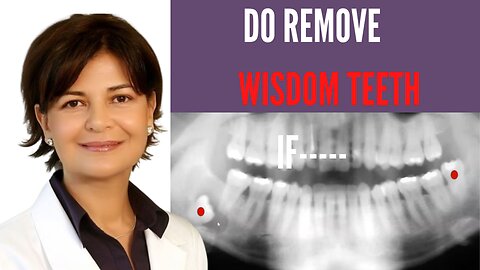 Do remove wisdom teeth if...