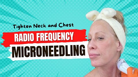 Tighten My Neck & Improve Chest Wrinkles with RF Microneedling