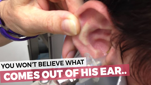 This Kid Has The Nastiest Ears You'll Ever See