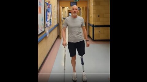 Alex Mitchell Lost His Leg After Having the AstraZeneca Vaccination
