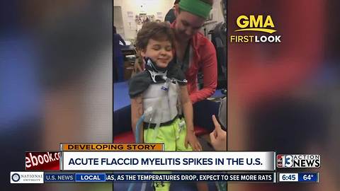 New polio-like illness scaring people