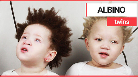 Parents of rare albino twins accused of having affairs