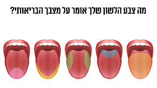 מה צבע הלשון שלך אומר על מצבך הבריאותי?