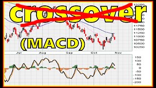 🔴 MACD Reversal Timing With NO "MACD Crossover Strategy" For Trading Stocks Cryptos Forex Bonds ETFs